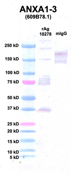 Western Blot using CPTC-ANXA1-3 as primary Ab against Ag 10278 (lane 2). Also included are molecular wt. standards (lane 1) and mouse IgG control (lane 3).